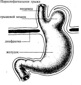 диета третья отрицательная группа